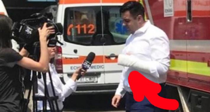 Ce ghinion pe români: ministrul Transporturilor și-a rupt exact mâna cu care făcea autostrăzi!